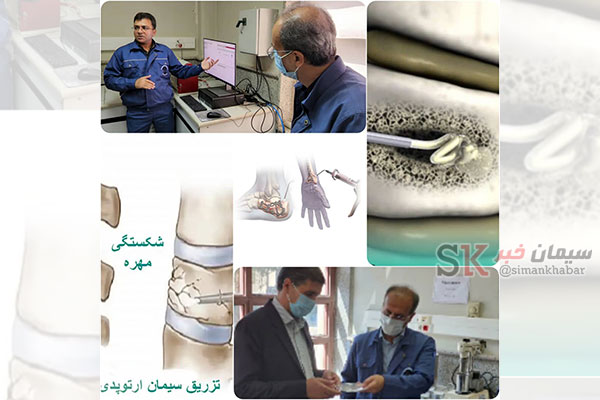 تولید آزمایشگاهی ترکیبات سیمان استخوانی (Bone cement) در گروه صنایع سیمان کرمان